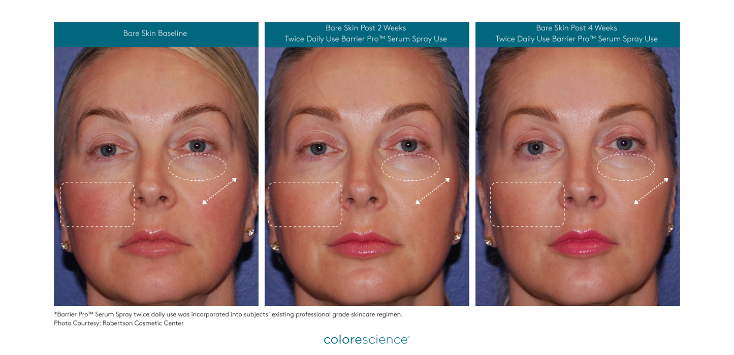 Colorescience Barrier Pro™ Serum Spray