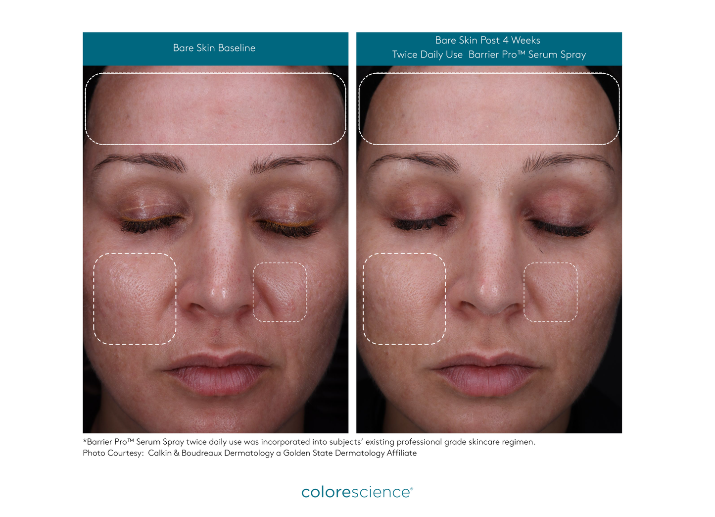 Colorescience Barrier Pro™ Serum Spray