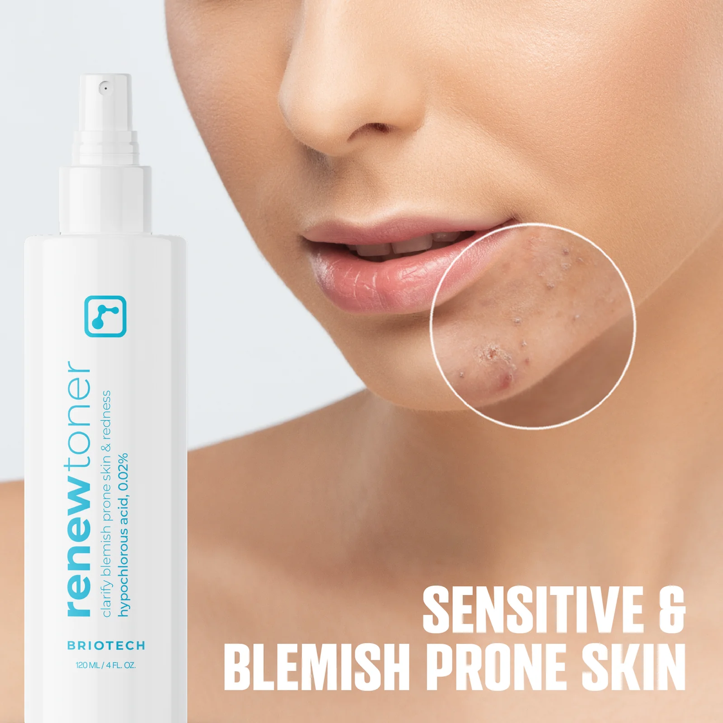Briotech Skin Renew Toner