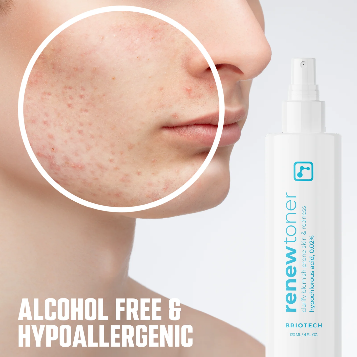 Briotech Skin Renew Toner